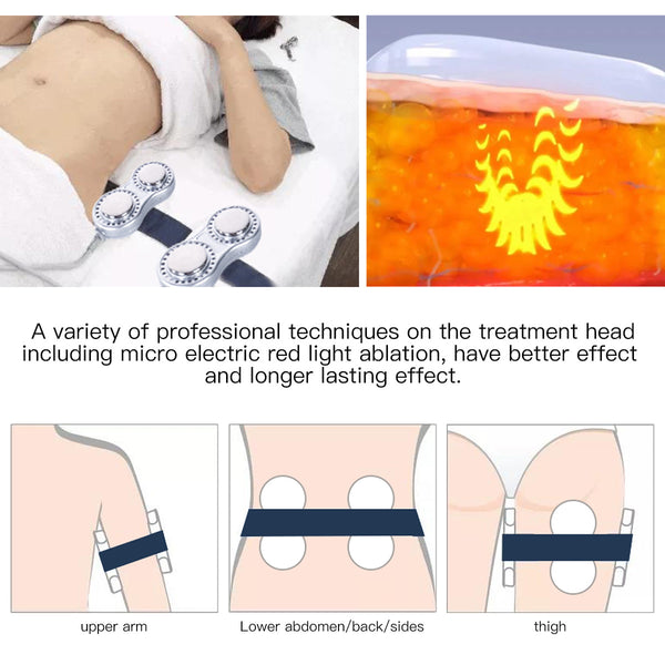 SQ47B Pro: dispositivo 6 in 1 con cavitazione 40K, radiofrequenza, massaggio a vuoto, laser, EMS